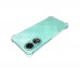 for Oppo A78 4G Soft TPU Case- Alfaa Case