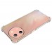 for Vivo Y38 5G Soft TPU Case- Alfaa Case