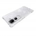for Vivo Y400 Pro 5G Soft TPU Case- Alfaa Case for Vivo Y400 Pro 5G Soft TPU Case- Alfaa Case